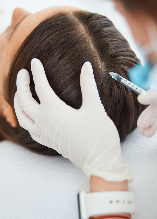 Hair Restoration Treatment Miami