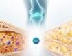 Bone Marrow vs. Adipose-Derived Stem Cells: Which Is Better for Joint Pain
